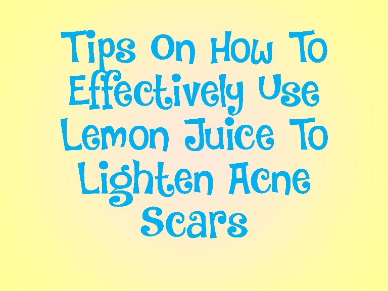 Tips On How To Effectively Use Lemon Juice To Lighten Acne Scars
