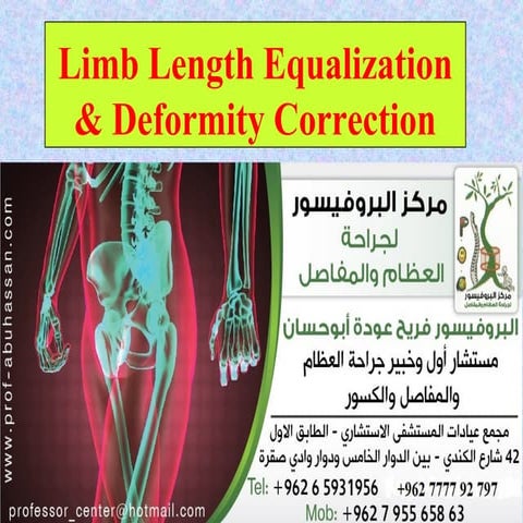  تطويل العظام في الاردن-  Limb lengthening - البروفيسور فريح ابوحسان - استشار...