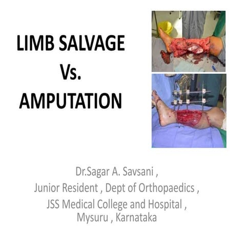 Limb salvage vs amputation final