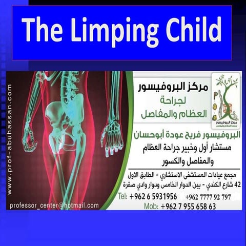   العرج عند الاطفال - Limping child - البروفيسور فريح ابوحسان - استشاري جراحة...