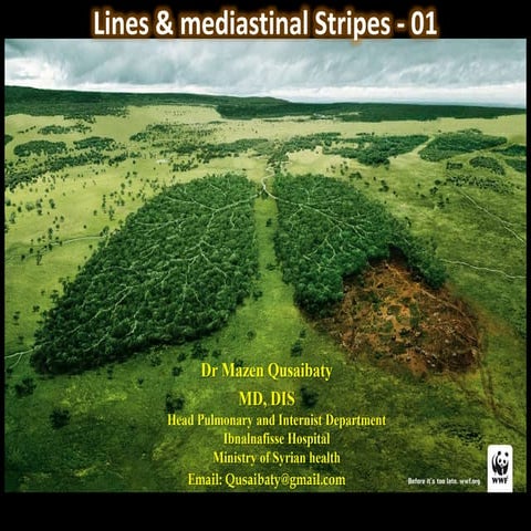Lines & mediastinal stripes 01