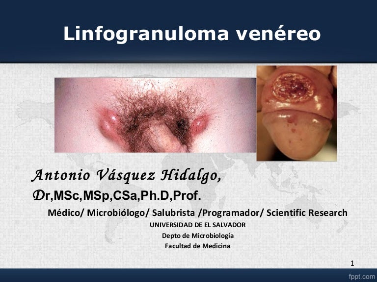 uretritis ganglios linfáticos inguinales
