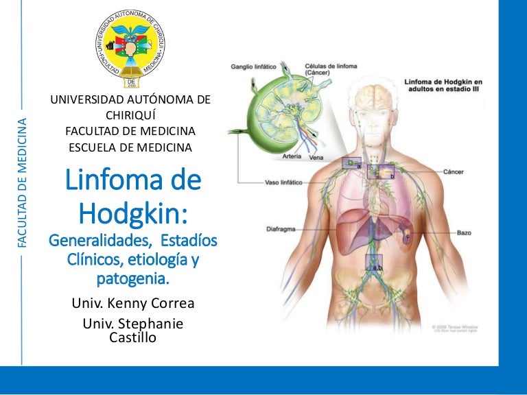 Linfoma De Hodgkin Que Es Y Que Efectos Tiene El Linfoma De Hodgkin Que Sufre Carla Suarez