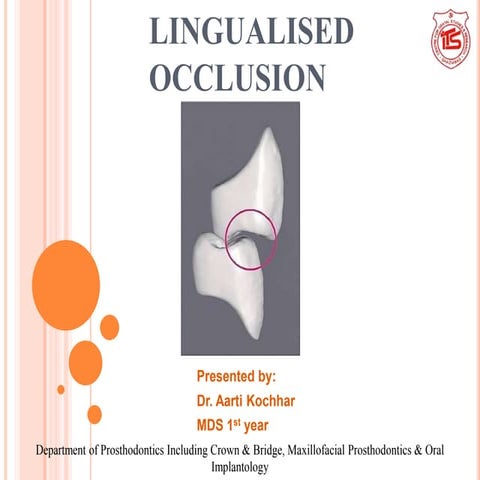 Lingualised occlusion revisited