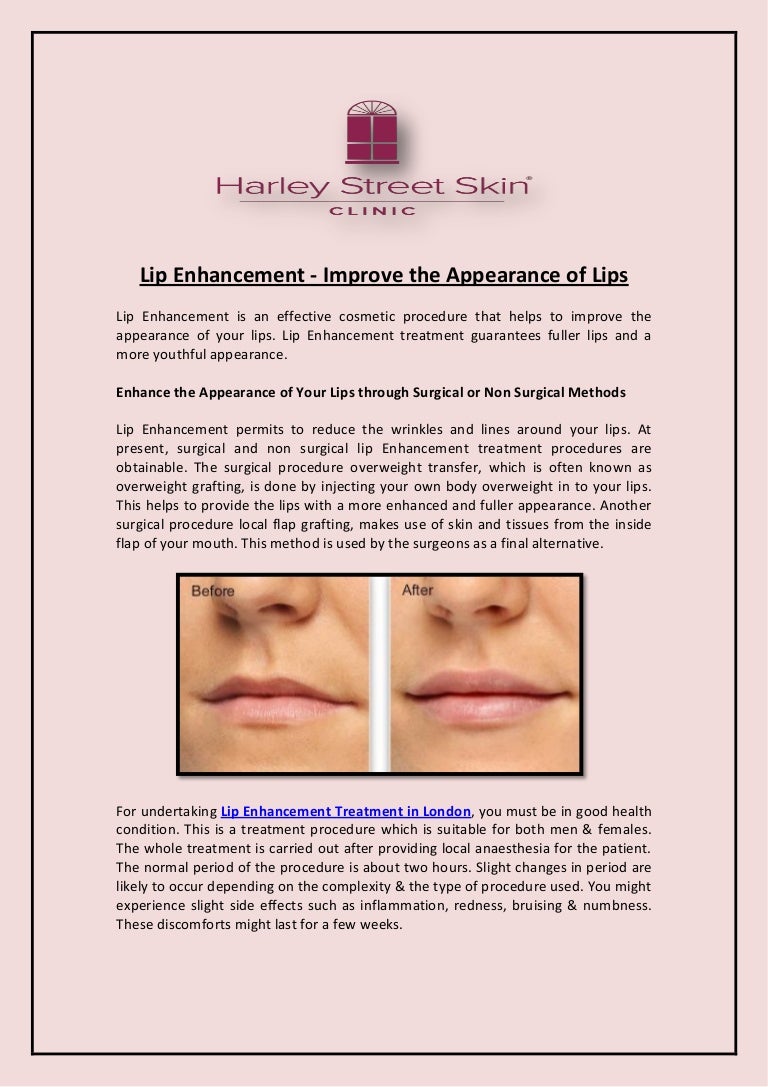 Lip enhancement improve the appearance of lips