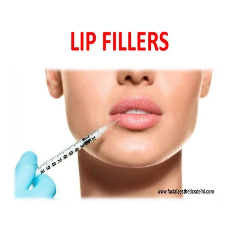 Lip fillers