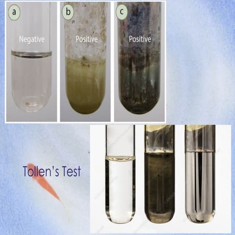 LIPIDS a topic that focuses on Lipids membranes
