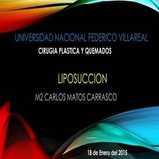 Liposuccion CARLOS MATOS