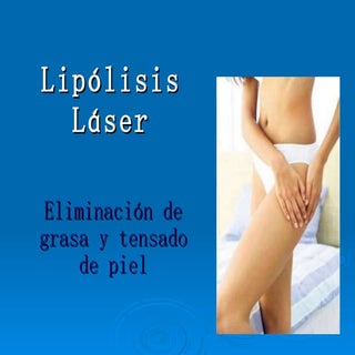 Lipolisis laser: lipo sin cirugia c...