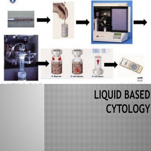 Liquid based cytology ( l b c) | PPTX