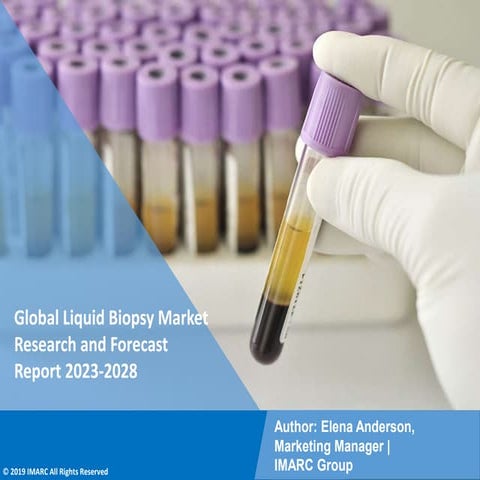 Liquid Biopsy Market PPT 2023: Size, Growth, Demand and Forecast till 2028