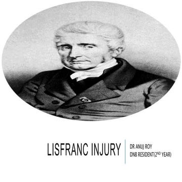 Lisfranc injuries