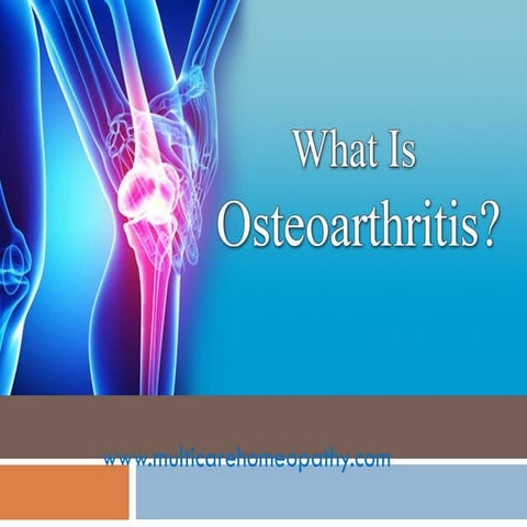 List of 6 best homeopathic medicines for osteoarthritis