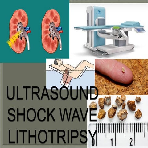 Lithotrypsy