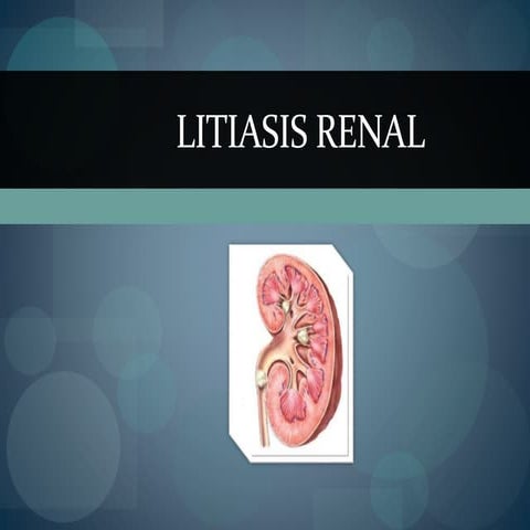 Litiasis renal también denominada urolitiasis