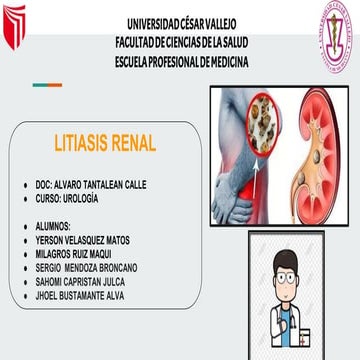 Litiasis Renal.pptx