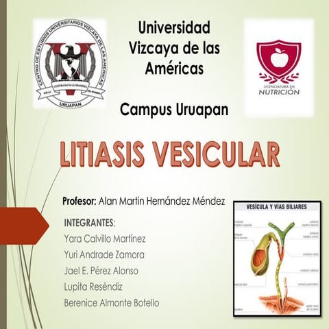 Litiasis vesicular