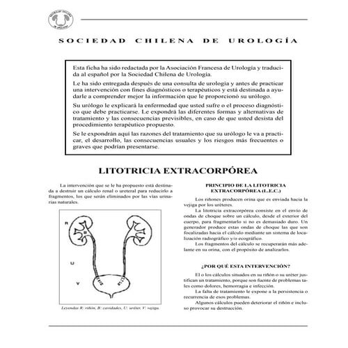 Litotricia ec
