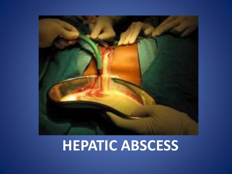 Liver Abscess Drain