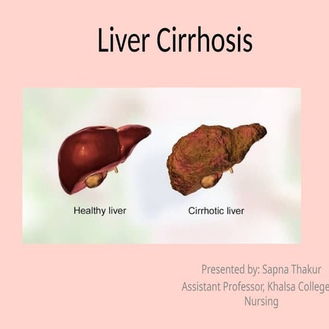 Liver_Cirrhosis_Sapna_Thakur_Presentation.pptx