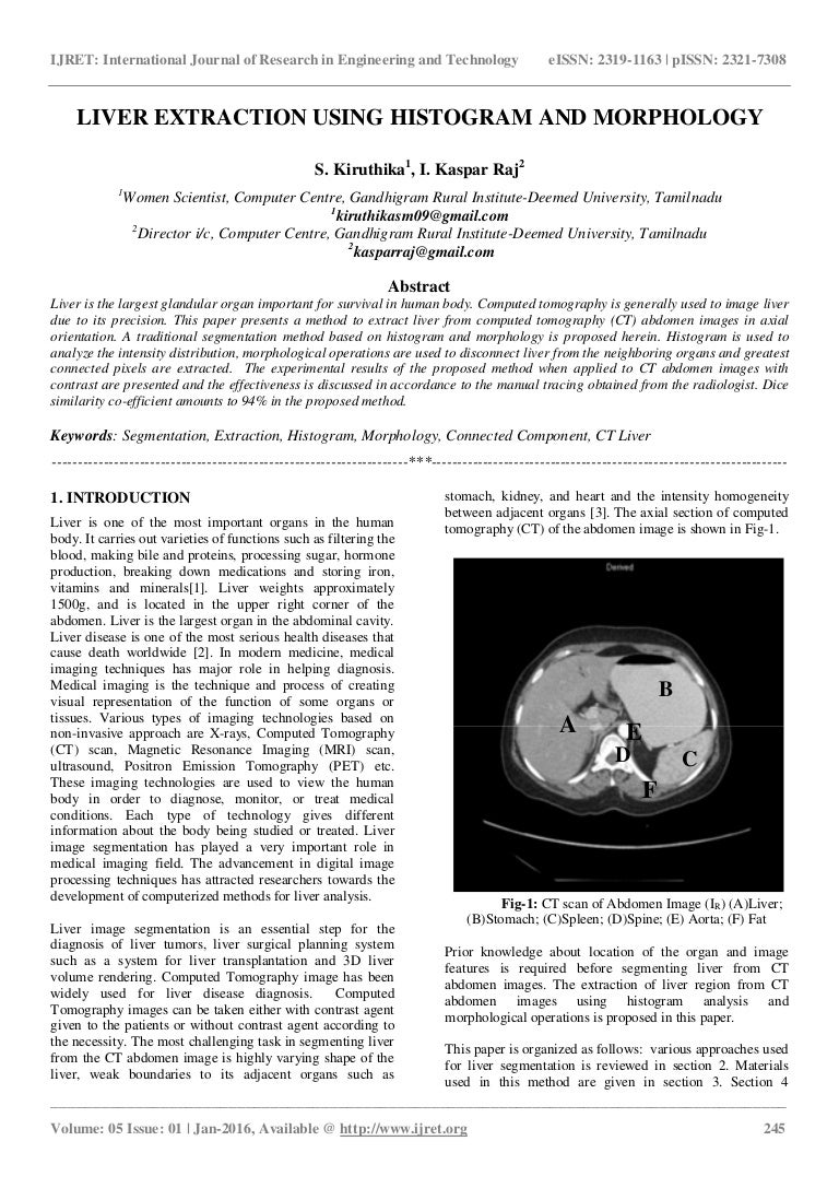 Liver extraction using histogram and morphology