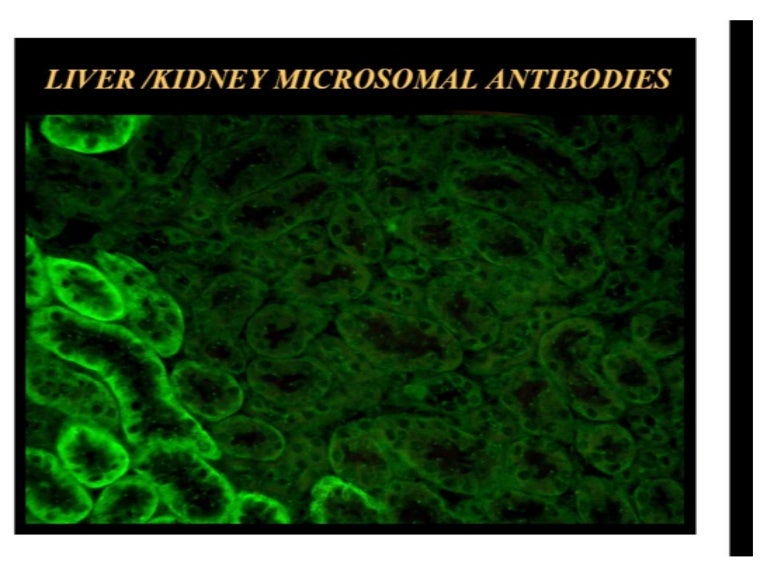 Liver kidney microsomal antibody