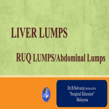 LIVER LUMPS- Rt Upper Quadrant Lumps- Abdominal Lumps.pptx