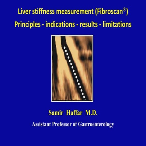 Liver stiffness measurement (fibroscan®)
