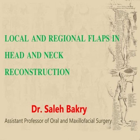 Local and regional flaps in head and neck reconstruction