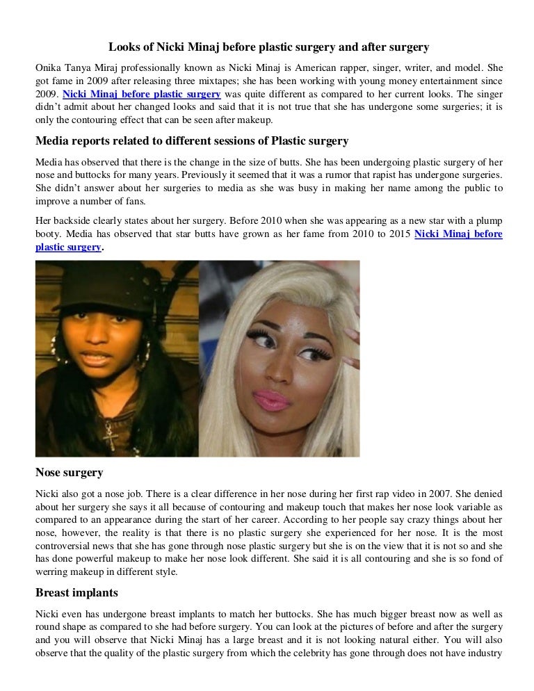 Nicki Minaj Plastic Surgery