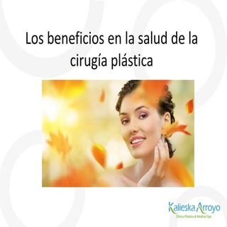 Kalieska Arroyo | Los beneficios en...