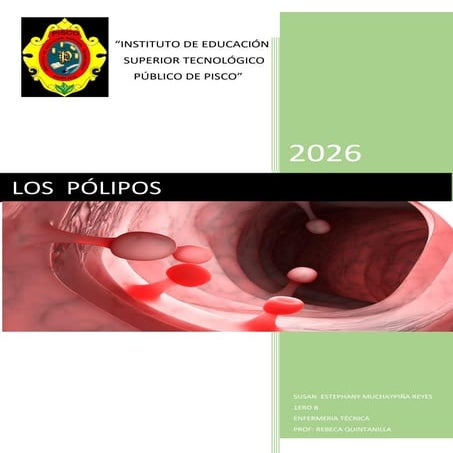 Comprehensive Overview of Polyps: Types, Symptoms, Diagnosis, and ...
