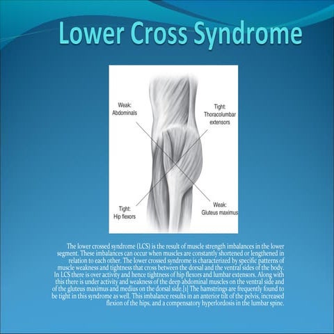 Lower cross syndrome