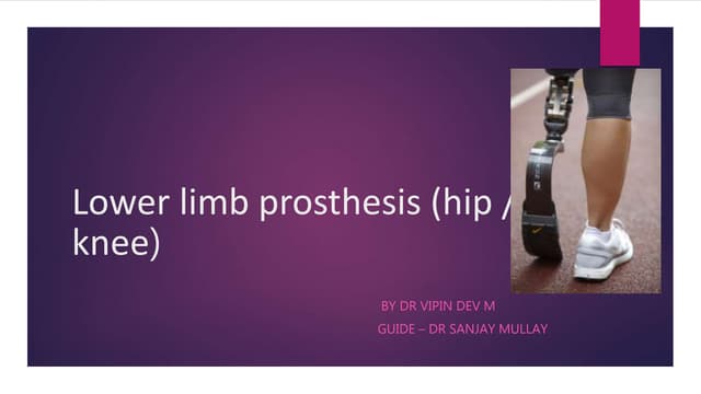 PROSTHETIC MANAGEMENT OF TRANSTIBIAL AMPUTATION AND ITS BIOMECHANICS | PDF