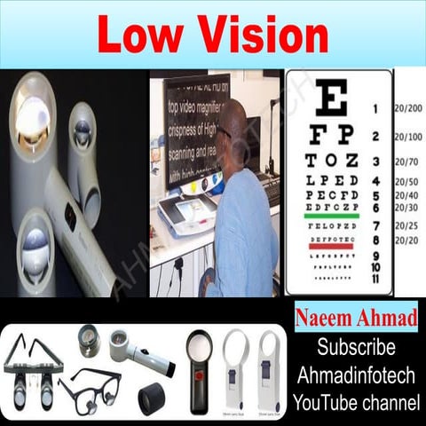 WHAT IS LOW VISION | LOW VISION INSTRUMENTS | LOW VISION SYMPTOMS  | TYPES OF...