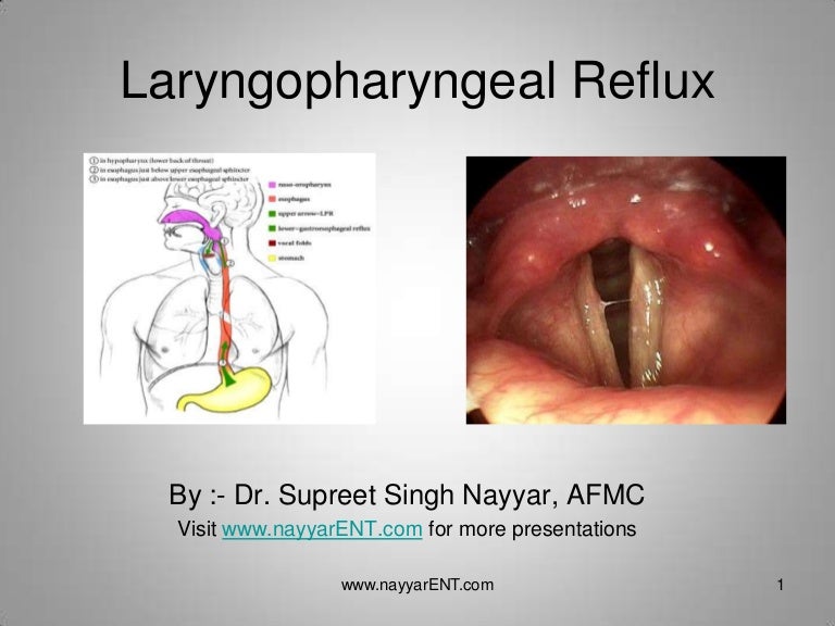 LPR Laryngopharyngeal Reflux lpr-laryngopharyngeal-reflux