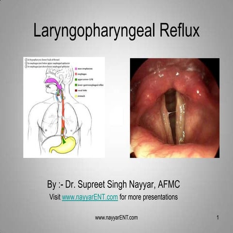 LPR Laryngopharyngeal Reflux