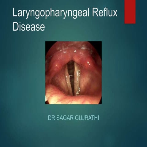 Laryngopharyngeal reflux disease (LPRD) by Dr Sagar Gujrathi.ppt