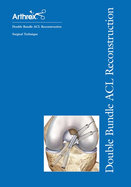 Workshop de biceps distal ist 2009-print | PPT