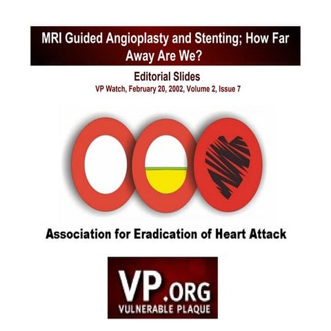 Cardiac ct ccta | PPT