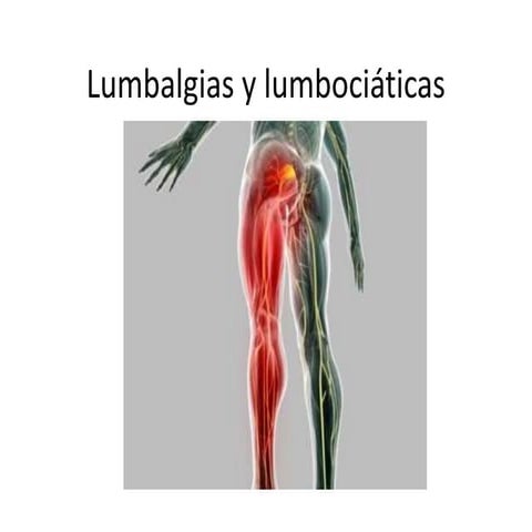 Lumbalgias y lumbociáticas