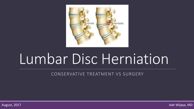 Herniated Nucleus Pulposus (HNP).pptx