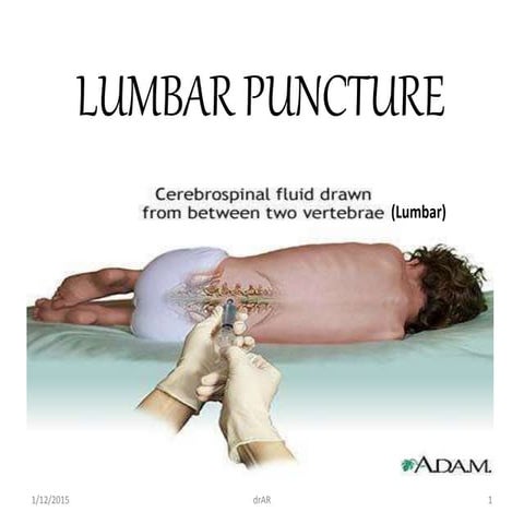 Lumbar puncture 