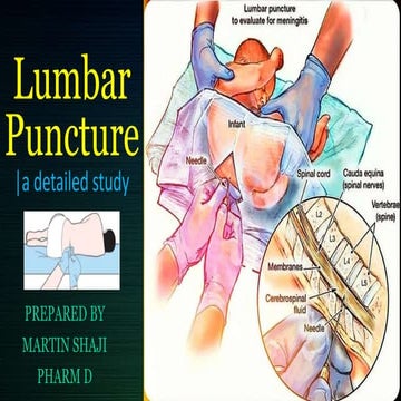 Lumbar puncture - a detailed medical study | all aspects of lumbar ...