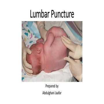 Lumbar Puncture Baby Medical Research And Resources On Infant Spinal