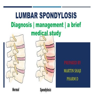 Lumbar spondylosis- Diagnosis | management | a brief medical study 