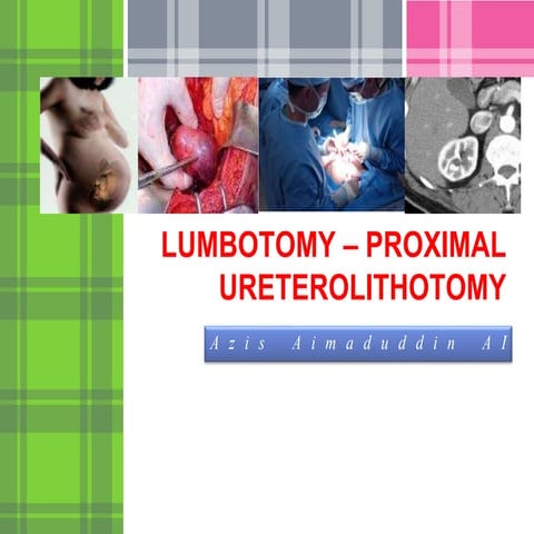 Open Pyelolithotomy | PPTX