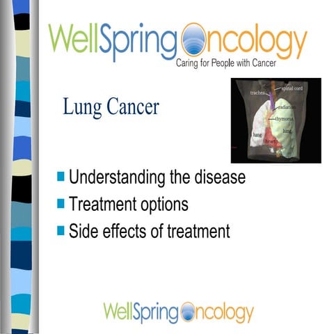 Lung Cancer