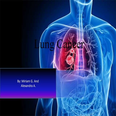 Lung cancer ll | PPT
