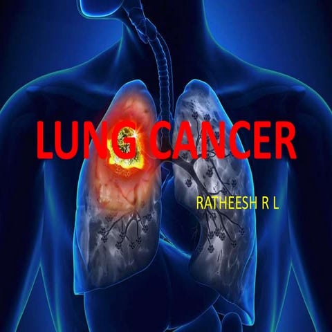 LUNG CANCER MICRO TEACHING pptx